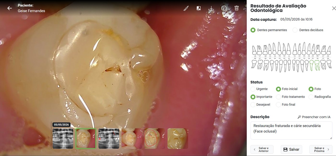Relatório de avaliação odontológica com fotos clínicas e odontograma