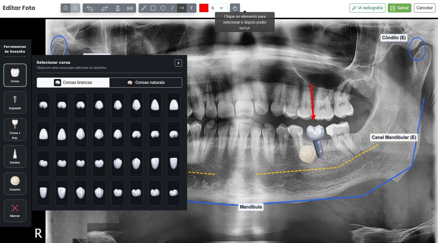 Radiografia panorâmica aberta no AWBook para análise e planejamento clínico