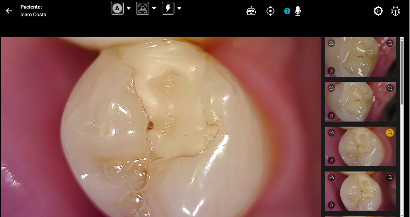 Tela de captura ao vivo do AWBook com foto intraoral e miniaturas recentes